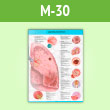 Плакат «Заболевания легких» (М-30, самокл. пленка, A2, 1 лист)